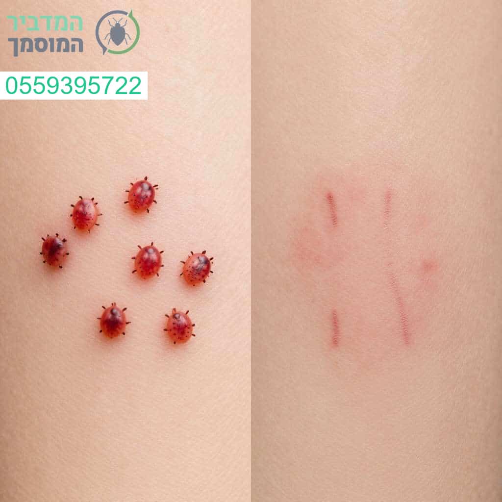 זיהוי והבחנה מקצועית בין עקיצות פרעושים לעקיצות פשפש המיטה לצורך טיפול ממוקד ויעיל