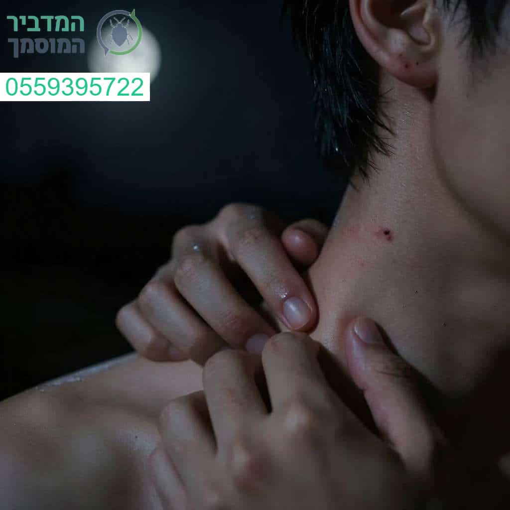אל תתנו לגרד הבלתי מוסבר לגנוב לכם את השינה אנחנו כאן כדי להשיב לשקט ולפתור כל בעיית מזיקים בבית